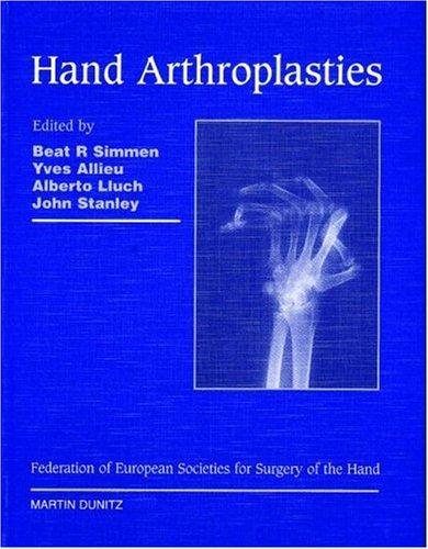 Couverture : Hand arthroplasties