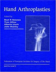 Couverture : Hand arthroplasties