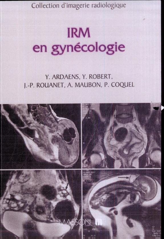 Couverture : IRM en gynécologie