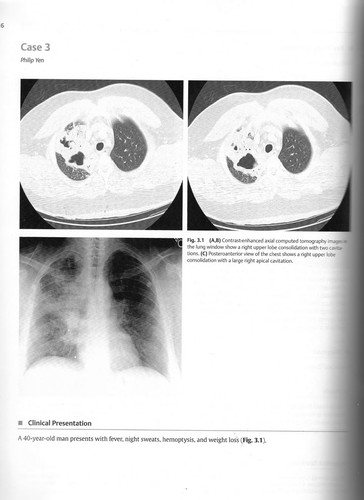Couverture : Top 3 differentials in radiology