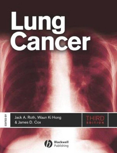 Couverture : Lung cancer