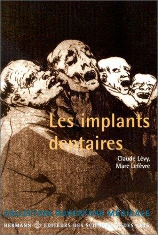 Couverture : Les Implants dentaires