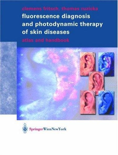 Couverture : Fluorescence Diagnosis and Photodynamic Therapy of Skin Diseases