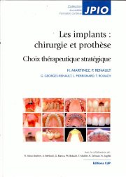 Couverture : Les implants