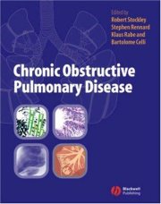 Couverture : Chronic obstructive pulmonary disease