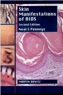 Couverture : Skin manifestations of AIDS