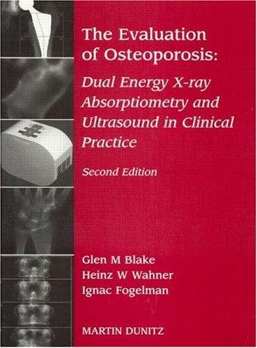Couverture : The Evaluation of Osteoporosis