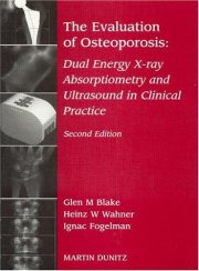 Couverture : The Evaluation of Osteoporosis