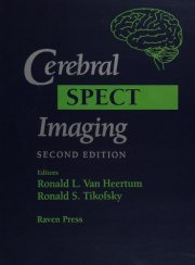 Couverture : Cerebral SPECT imaging