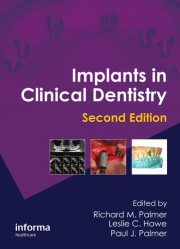 Couverture : Implants in Clinical Dentistry, Second Edition