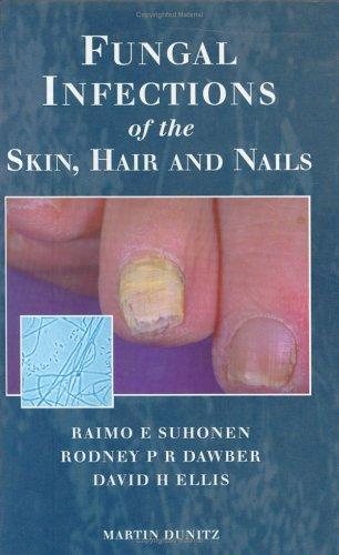 Couverture : Fungal Infections of the Skin and Nails