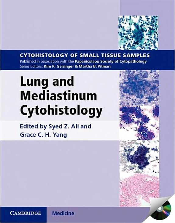 Couverture : Lung and Mediastinum Cytohistology with CD-ROM