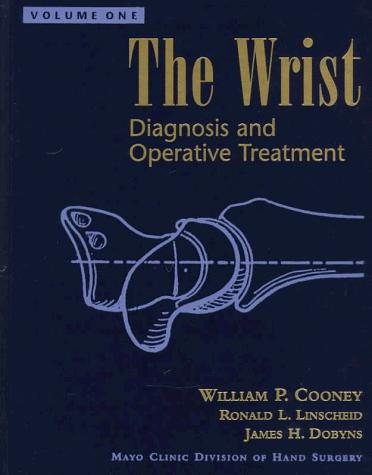 Couverture : The Wrist