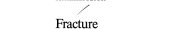 Couverture : Fracture at High Temperatures