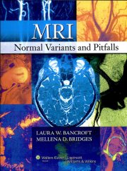 Couverture : MRI normal variants and pitfalls