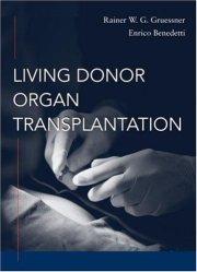 Couverture : Living donor organ transplantation