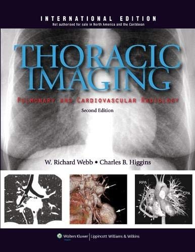 Couverture : Thoracic Imaging
