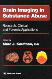 Couverture : Brain Imaging in Substance Abuse