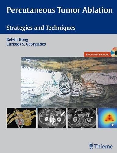 Couverture : Percutaneous tumor ablation