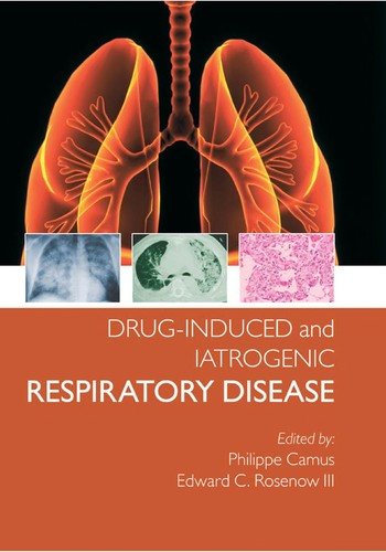 Couverture : Drug-Induced and Iatrogenic Lung Disease