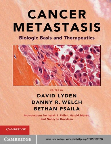Couverture : Cancer metastasis