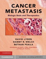 Couverture : Cancer metastasis