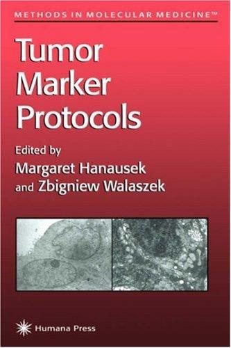 Couverture : Tumor marker protocols