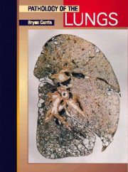 Couverture : Pathology of the Lungs
