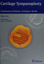 Couverture : Cartilage tympanoplasty