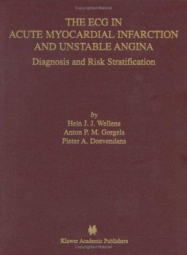 Couverture : The ECG in acute myocardial infarction and unstable angina