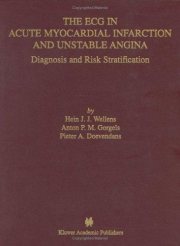 Couverture : The ECG in acute myocardial infarction and unstable angina