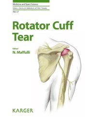 Couverture : Rotator cuff tear