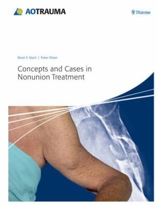 Couverture : Concepts and cases in nonunion treatment